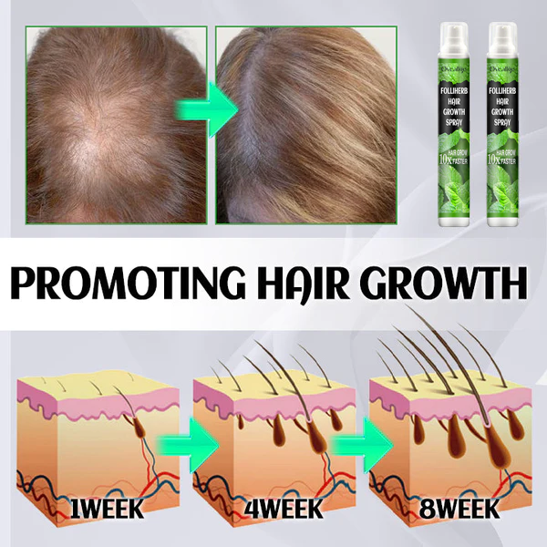 Oveallgo™ FolliHerb Hair Growth Spray