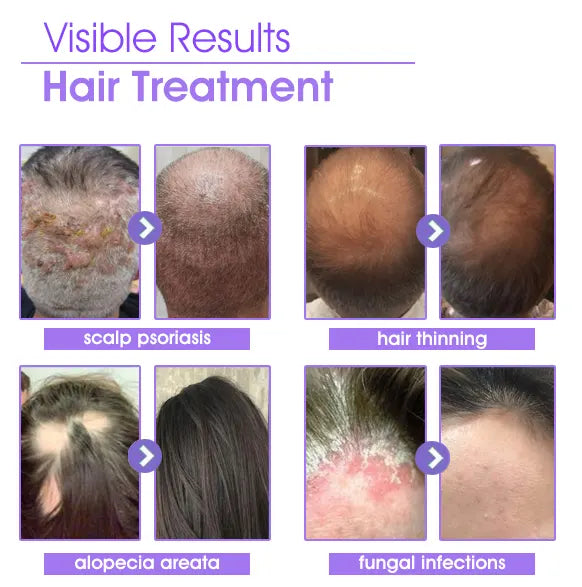Oveallgo™ Hair Follicle Repair Hair Growth Drops - Achieve thicker hair quickly
