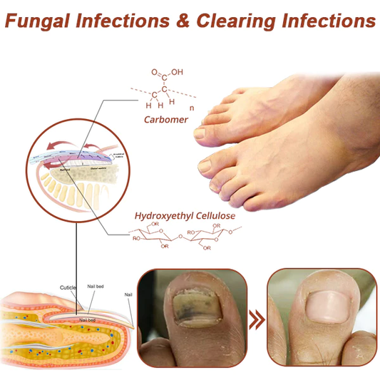 Oveallgo™ Revolutionary High-Efficiency Light Therapy Device For Toenail Diseases