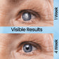 Oveallgo™ Cataract and Glaucoma Mositurizing Eye Drops