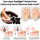 Oveallgo™ IHerbal Foot Callus And Corns Removal Soak