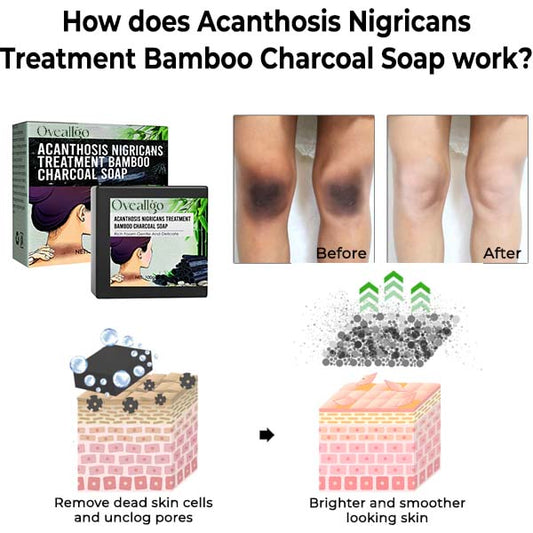 Oveallgo™ Acanthosis Nigricans Treatment Bamboo Charcoal Soap
