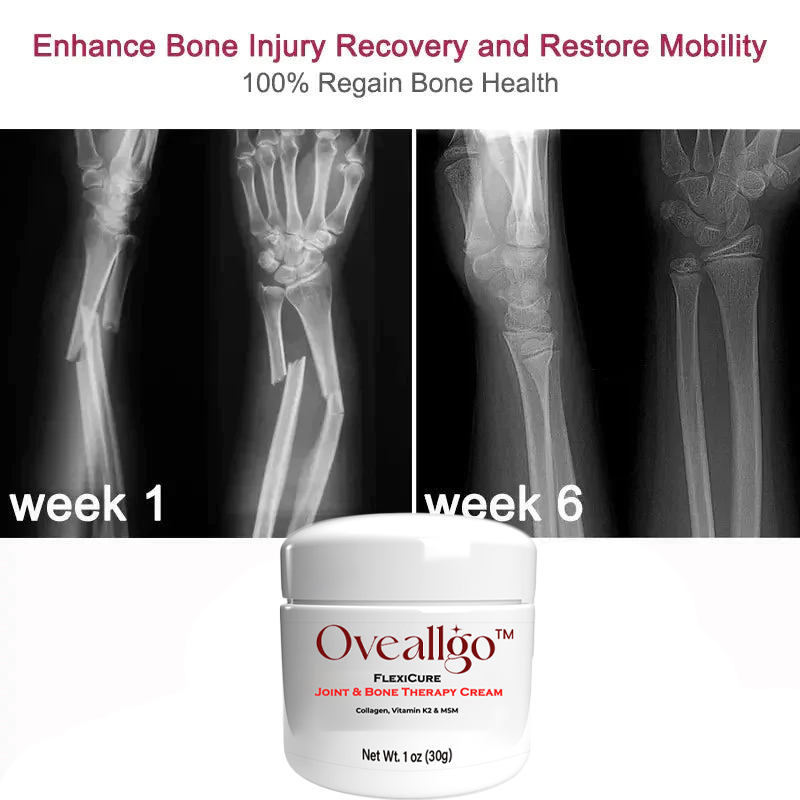 Oveallgo™ FlexiCure Joint & Bone Therapy Cream