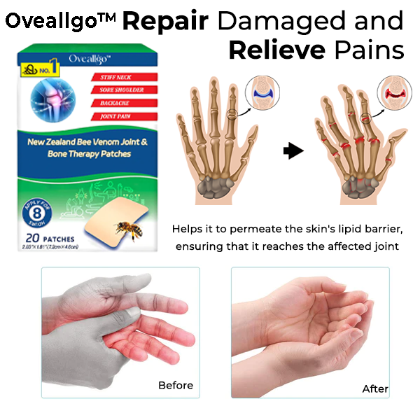Oveallgo™ New Zealand Bee Venom Joint & Bone Therapy Patches