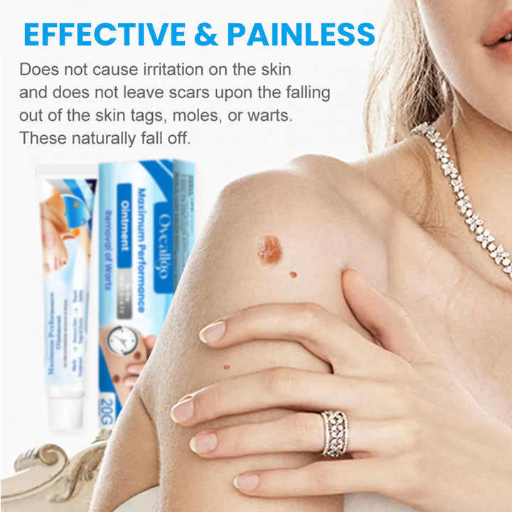 Oveallgo™ Maximum Performance Ointment for the Immediate removal of Warts