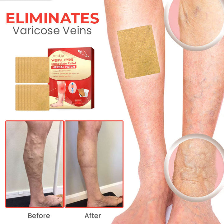 Oveallgo™ VeinLess Immediate Relief Herbal Patch