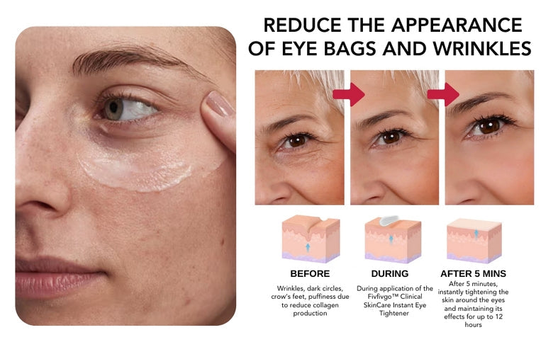 Oveallgo™ Clinical SkinCare Instant Eye Tightener