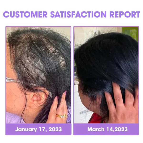 Oveallgo™ Hair Follicle Repair Hair Growth Drops - Achieve thicker hair quickly